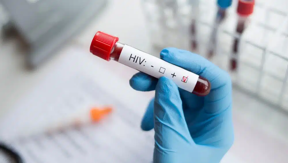 hiv-aids-izmir